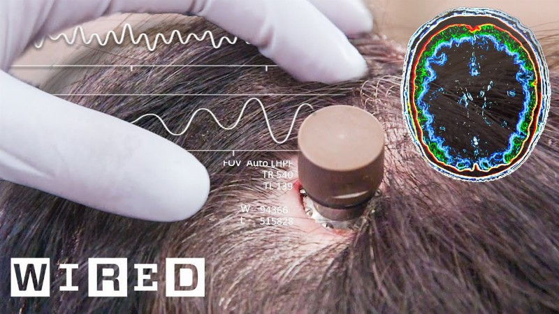 The Science Behind Elon Musk’s Neuralink Brain Chip : Wired